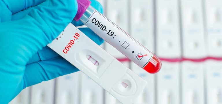 308 Corona-Neuinfektionen in MV gemeldet