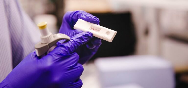 Schnelltest-Ergebnis soll künftig 24 Stunden gelten