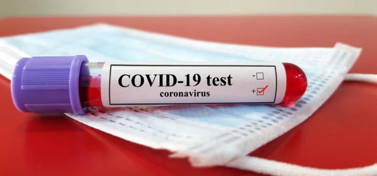 Covid19 in Nordwestmecklenburg – Montag (08.03.21)