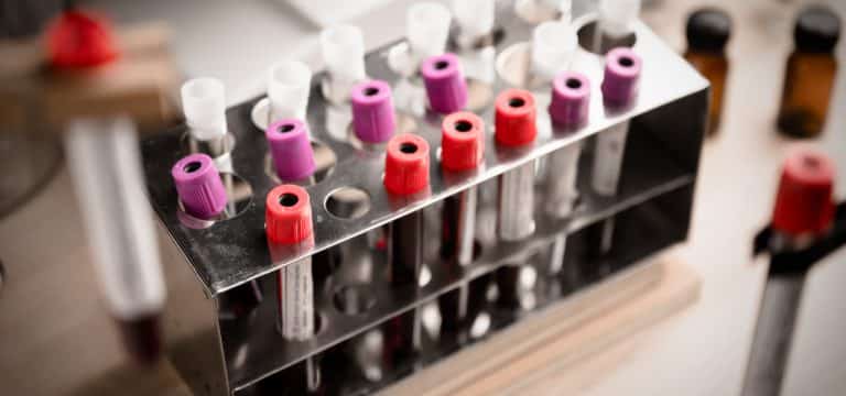 58 Corona-Neuinfektionen in MV: Inzidenz sinkt auf 84,6