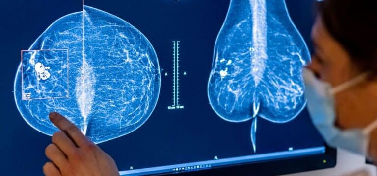 Kostenlose Brustkrebsvorsorge nun auch für Frauen ab 70