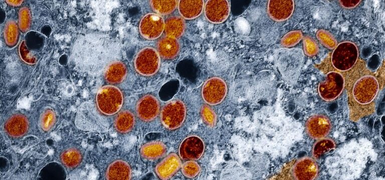 Hohes Pandemierisiko: Experten warnen vor globaler Bedrohung durch Mpox