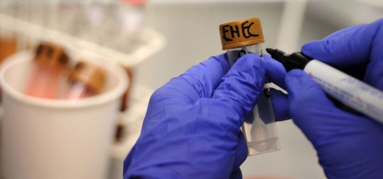 Zahl der Ehec-Infektionen gestiegen – Kein neuer HUS-Fall