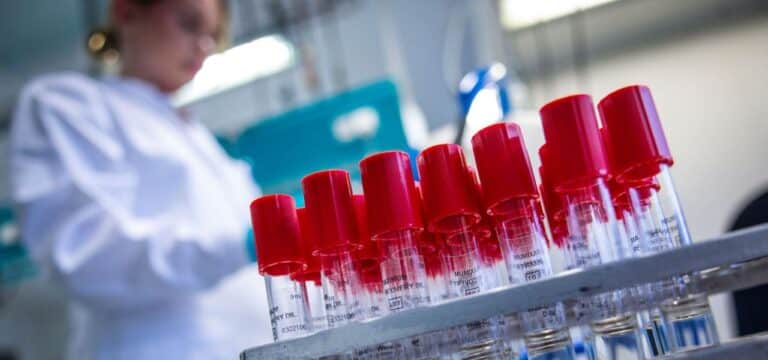 Keine Entwarnung: Zahl der Ehec-Fälle in MV wieder gestiegen